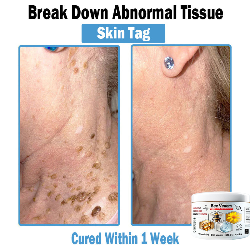 4 Jars-Visible Skin Improvement